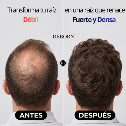 Cabello más fuerte y denso en 90 días con REBORN® InFusion